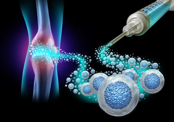 Understanding Stem Cell Treatment And Its Benefits