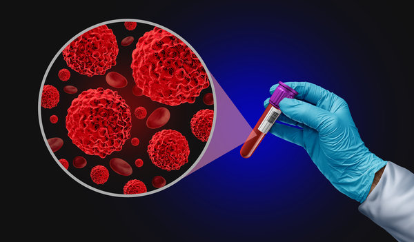 Why A Comprehensive Blood Biomarker Panel Is the Ultimate Wellness Tool